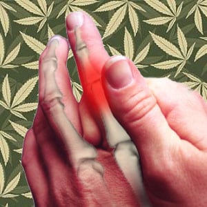 arthritis marijuana
