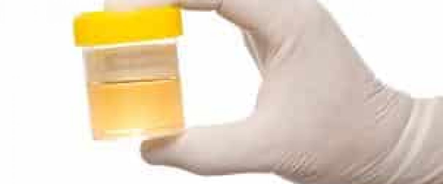 Urine Sample, how to pass a drug test