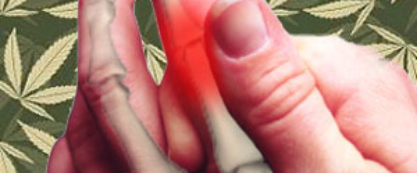 Is Medical Marijuana The Safest Treatment For Arthritis? promo image