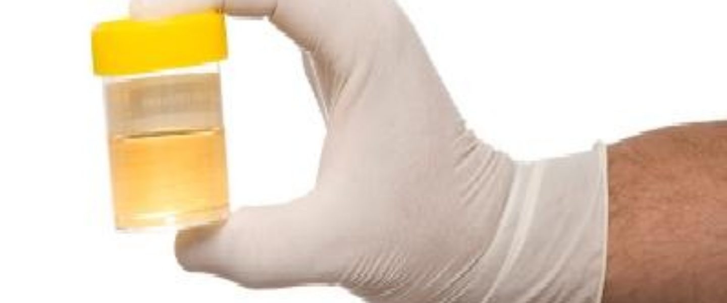 Urine Sample, how to pass a drug test