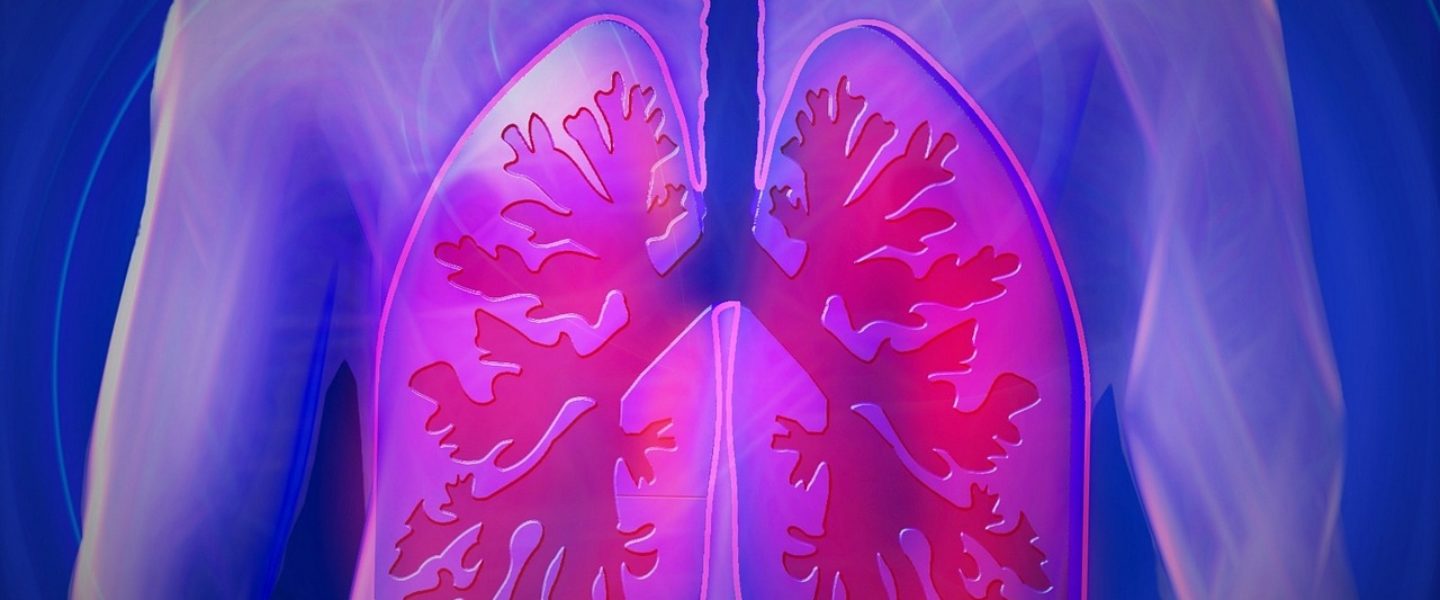 cannabis-derived CBD for treating the lung inflammation that accompanies COVID-19