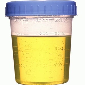 urine specimen